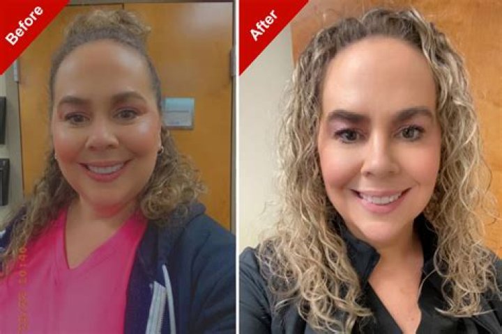Before & After Pics — Did She Remove Implants? – Hollywood Life