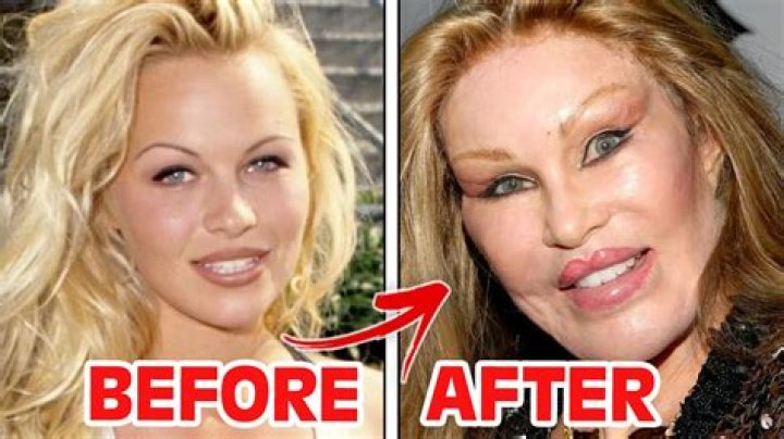Did She Get Plastic Surgery? – Hollywood Life